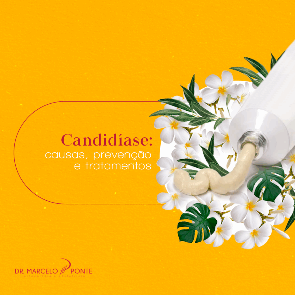 Candidíase: causas, prevenção e tratamentos