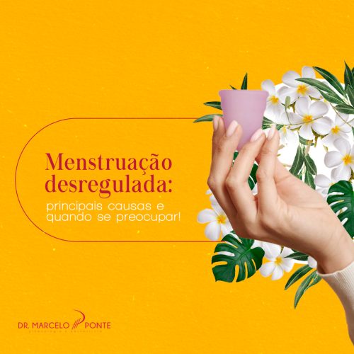 ARTIGO_Menstruação desregulada_ principais causas e quando se preocupar!