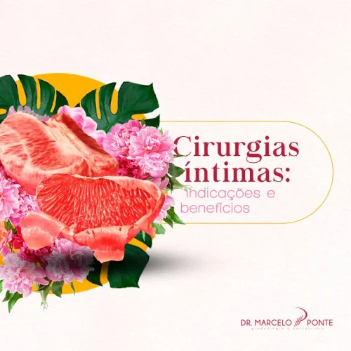 Cirurgias Íntimas_ Indicações e Benefícios