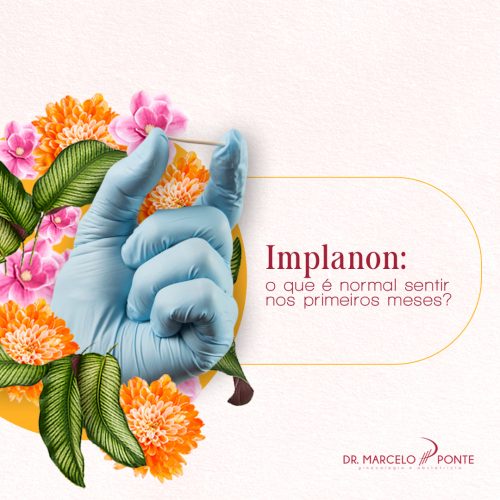 Implanon_ o que é normal sentir nos primeiros meses