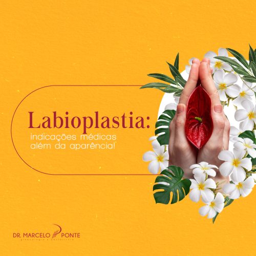 Labioplastia_ indicações médicas além da aparência! (1)