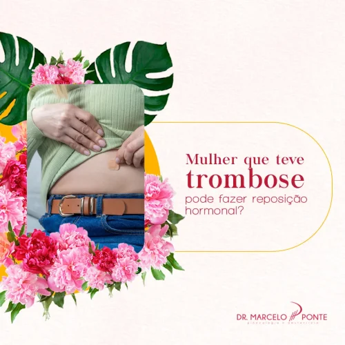Mulher que teve trombose pode fazer reposição hormonal?