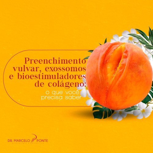 Preenchimento Vulvar, Exossomos e Bioestimuladores de Colágeno_ O Que Você Precisa Saber