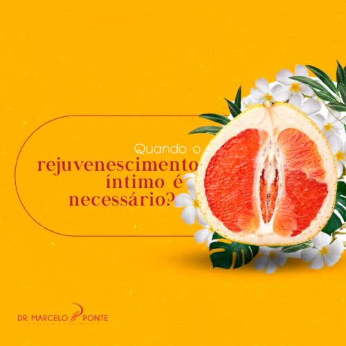 Dr. Marcelo Ponte - Ginecologista em São Paulo