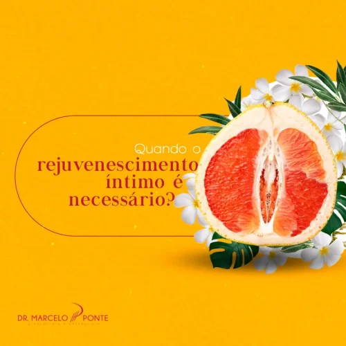 Dr. Marcelo Ponte - Ginecologista em São Paulo