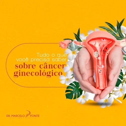 Dr. Marcelo Ponte - Ginecologista em São Paulo