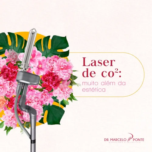 Laser de CO2