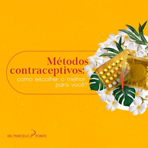 Métodos Contraceptivos: Como Escolher o Melhor para Você?