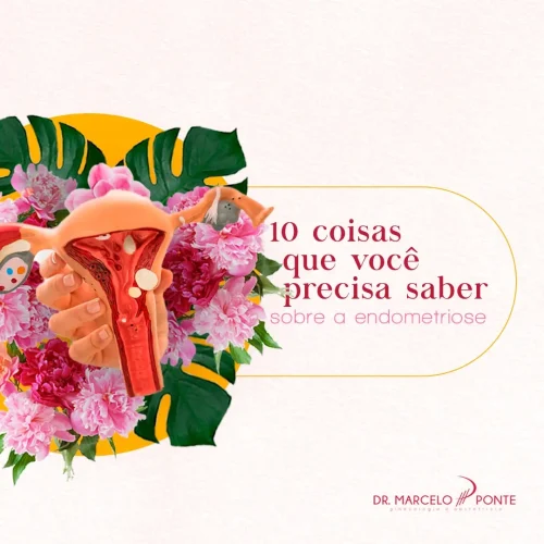 10 Coisas Que Você Precisa Saber Sobre a Endometriose