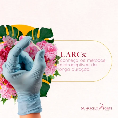 Dr. Marcelo Ponte - Ginecologista em São Paulo