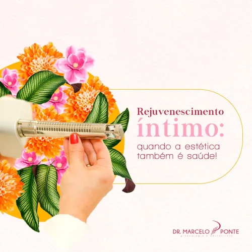 Rejuvenescimento íntimo: quando a estética também é saúde!