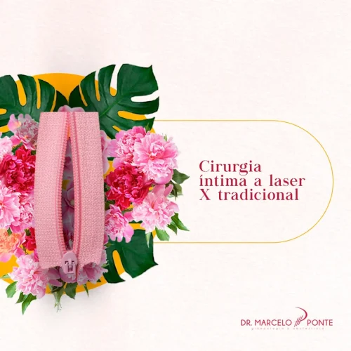 Cirurgia íntima a laser x tradicional: qual é a melhor opção para você?
