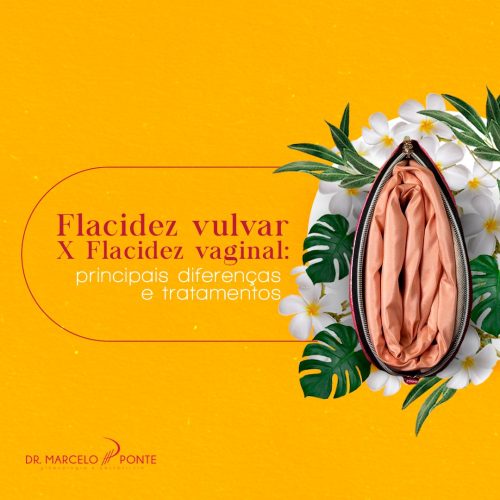Flacidez vulvar X Flacidez vaginal: diferenças e tratamentos