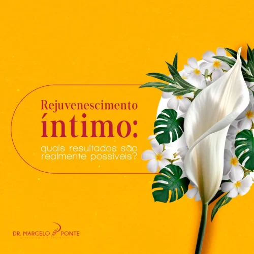 Rejuvenescimento Íntimo: quais resultados são realmente possíveis?