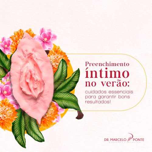 Preenchimento íntimo no verão: cuidados essenciais para garantir bons resultados!