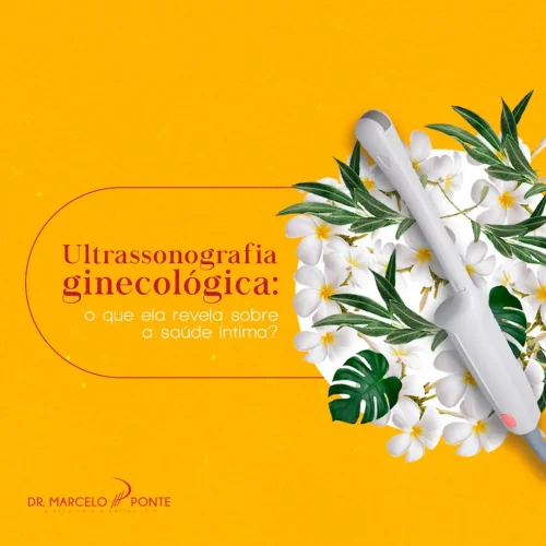 Ultrassonografia ginecológica: o que ela revela sobre a saúde íntima?