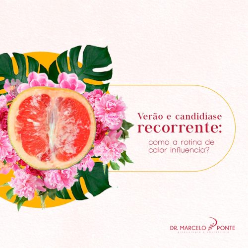Verão e candidíase recorrente: como a rotina de calor influencia?